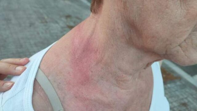 Imatge d'una de les dones atacades (Mossos d'Esquadra)